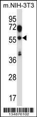 Anti-TEAD2 Rabbit Polyclonal Antibody (APC (Allophycocyanin))