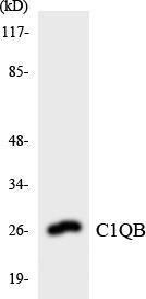 Western blot analysis of the lysates from Jurkat cells using Anti-C1QB Antibody