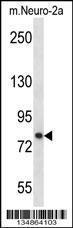 Anti-PRKCA Rabbit Polyclonal Antibody (FITC (Fluorescein Isothiocyanate))