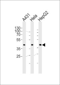 Anti-CSNK2A1 Rabbit Polyclonal Antibody