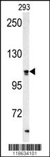 Anti-TUBB2A Rabbit Polyclonal Antibody