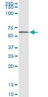 Anti-NAPRT Polyclonal Antibody Pair