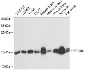 Western blot analysis of extracts of various cell lines, using Anti-Calcineurin B/CNB Antibody (A12720) at 1:1,000 dilution The secondary antibody was Goat Anti-Rabbit IgG H&L Antibody (HRP) at 1:10,000 dilution Lysates/proteins were present at 25 µg per lane