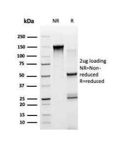 SDS-PAGE analysis of Anti-STAT5A Antibody [PCRP-STAT5A-1A11] under non-reduced and reduced conditions; showing intact IgG and intact heavy and light chains, respectively. SDS-PAGE analysis confirms the integrity and purity of the antibody