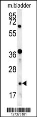 Anti-LOH12CR1 Rabbit Polyclonal Antibody