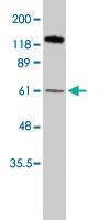 Anti-PPARG Rabbit Polyclonal Antibody