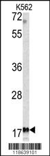 Anti-MFAP5 Rabbit Polyclonal Antibody