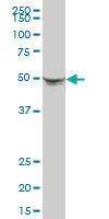 Anti-CK8 Mouse Polyclonal Antibody