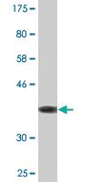 Anti-ZBP1 Mouse Monoclonal Antibody [clone: 2C10]