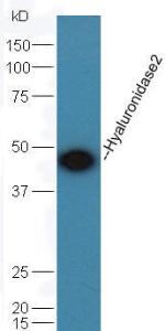 Anti-HYAL2 Rabbit Polyclonal Antibody