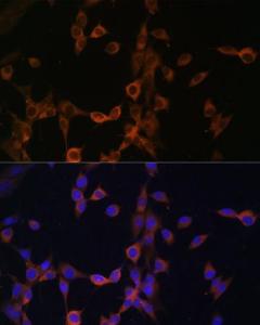 Immunofluorescence analysis of NIH/3T3 cells using Anti-Calcineurin B/CNB Antibody (A12720) at a dilution of 1:100 DAPI was used to stain the cell nuclei (blue)