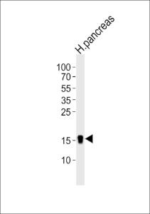 Anti-REG3A Rabbit Polyclonal Antibody