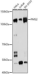 Western blot analysis of extracts of various cell lines, using Anti-PMS2 Antibody [ARC1039] (A307272) at 1:1,000 dilution. The secondary antibody was Goat Anti-Rabbit IgG H&L Antibody (HRP) at 1:10,000 dilution.