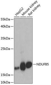 Western blot analysis of extracts of various cell lines, using Anti-NDUFB5 Antibody (A305727) at 1:1,000 dilution. The secondary antibody was Goat Anti-Rabbit IgG H&L Antibody (HRP) at 1:10,000 dilution.