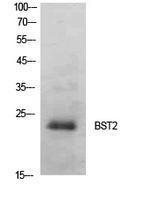 Western blot analysis of extracts from SKOV3 cells using Anti-BST2 Antibody