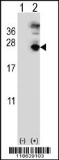 Anti-MFAP5 Rabbit Polyclonal Antibody