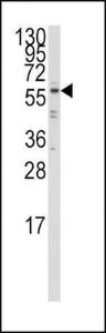 Anti-IRF5 Rabbit Polyclonal Antibody