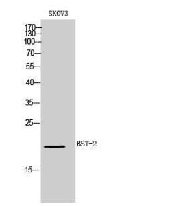 Western blot analysis of SKOV3 cells using Anti-BST2 Antibody