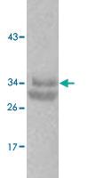 Anti-CASP7 Rabbit Polyclonal Antibody