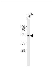 Anti-PSEN2 Rabbit Polyclonal Antibody