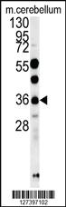 Anti-OTUD6B Rabbit Polyclonal Antibody