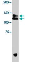 Anti-TRPA1 Rabbit Polyclonal Antibody