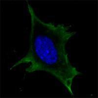 Anti-CALR Mouse Monoclonal Antibody [clone: 1G6A7]