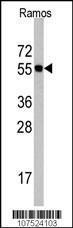 Anti-CDC6 Rabbit Polyclonal Antibody (AP (Alkaline Phosphatase))