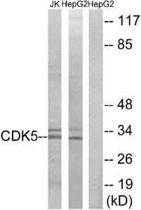 Western blot analysis of lysates from HepG2 and Jurkat cells using Anti-CDK5 Antibody. The right hand lane represents a negative control, where the antibody is blocked by the immunising peptide.