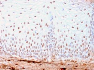 Immunohistochemical analysis of formalin-fixed, paraffin-embedded human skin using Anti-SOX2 Antibody [SOX2/3169R]