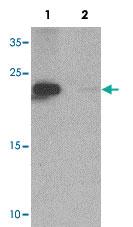 Anti-ZFYVE21 Rabbit Polyclonal Antibody