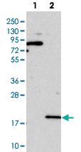 Anti-EDDM3B Rabbit Polyclonal Antibody