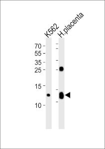 Anti-HBG2 Rabbit Polyclonal Antibody