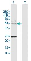 Anti-CK8 Rabbit Polyclonal Antibody