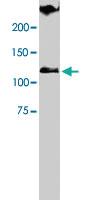 Anti-TRPA1 Rabbit Polyclonal Antibody