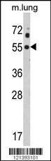 Anti-KCNJ2 Rabbit Polyclonal Antibody (HRP (Horseradish Peroxidase))