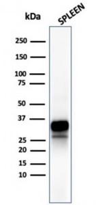 Western blot analysis of human spleen tissue lysate using Anti-Granzyme B Antibody [rGZMB/4538]