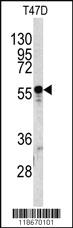 Anti-A1BG Rabbit Polyclonal Antibody