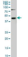 Anti-SGK2 Mouse Monoclonal Antibody [clone: 7C7]