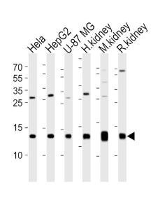 Anti-NDUFC2 Rabbit Polyclonal Antibody