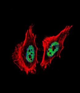 Anti-CTBP1 Rabbit Polyclonal Antibody (FITC (Fluorescein Isothiocyanate))