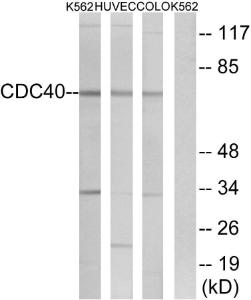 Western blot analysis of lysates from K56 COLO, and HUVEC cells using Anti-CDC40 Antibody. The right hand lane represents a negative control, where the antibody is blocked by the immunising peptide.