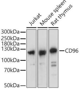 Western blot analysis of extracts of various cell lines, using Anti-CD96 Antibody (A305729) at 1:1,000 dilution. The secondary antibody was Goat Anti-Rabbit IgG H&L Antibody (HRP) at 1:10,000 dilution.