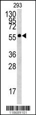 Anti-TNFRSF10D Rabbit Polyclonal Antibody