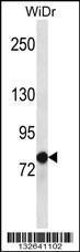 Anti-LZTS2 Rabbit Polyclonal Antibody (HRP (Horseradish Peroxidase))