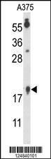 Anti-FA96B Rabbit Polyclonal Antibody (APC (Allophycocyanin))