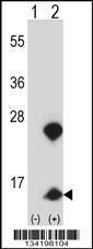 Anti-HMGN1 Rabbit Polyclonal Antibody (FITC (Fluorescein Isothiocyanate))