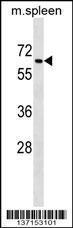 Anti-TGFBR2 Rabbit Polyclonal Antibody (AP (Alkaline Phosphatase))