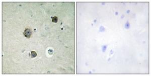 Immunohistochemical analysis of paraffin-embedded human brain tissue using Anti-CDK5 Antibody. The right hand panel represents a negative control, where the antibody was pre-incubated with the immunising peptide.