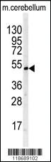 Anti-TNFRSF10D Rabbit Polyclonal Antibody